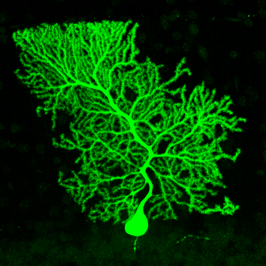 小脳プルキンエ細胞