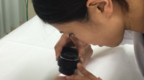 me-7.皮膚がんの早期発見・早期治療をめざした啓発活動と若手育成